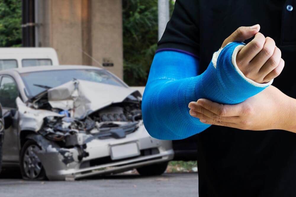 Hand and arm injures from car accident.